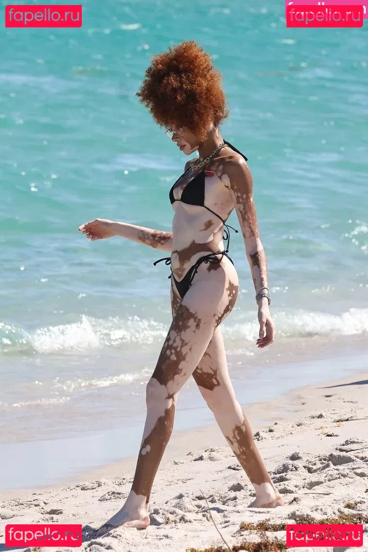 Winnie Harlow Onlyfans Photo Gallery 