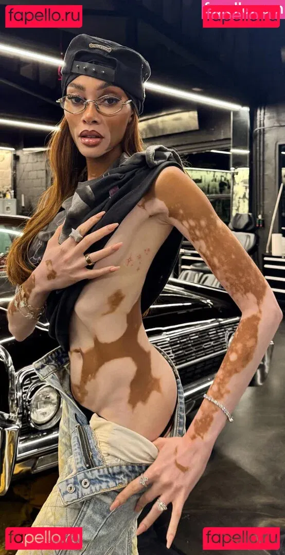 Winnie Harlow Onlyfans Photo Gallery 