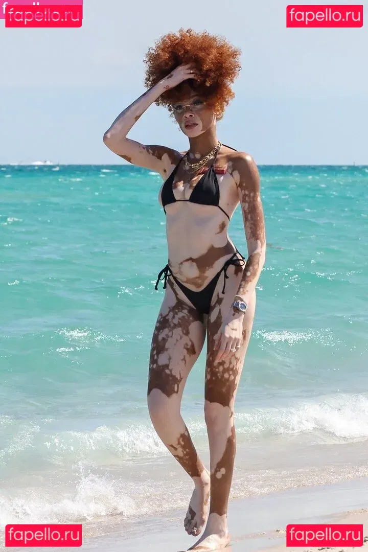 Winnie Harlow Onlyfans Photo Gallery 