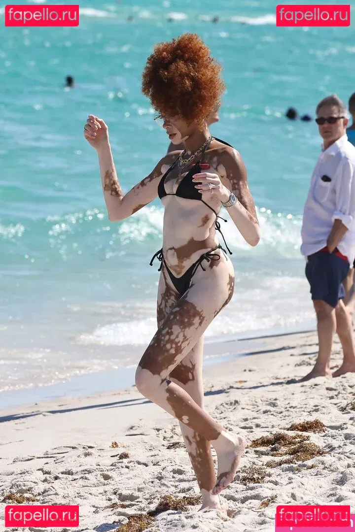 Winnie Harlow Onlyfans Photo Gallery 