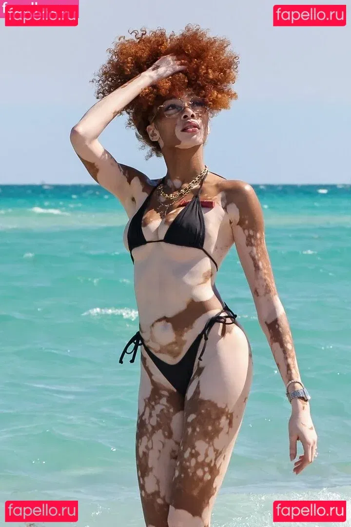 Winnie Harlow Onlyfans Photo Gallery 