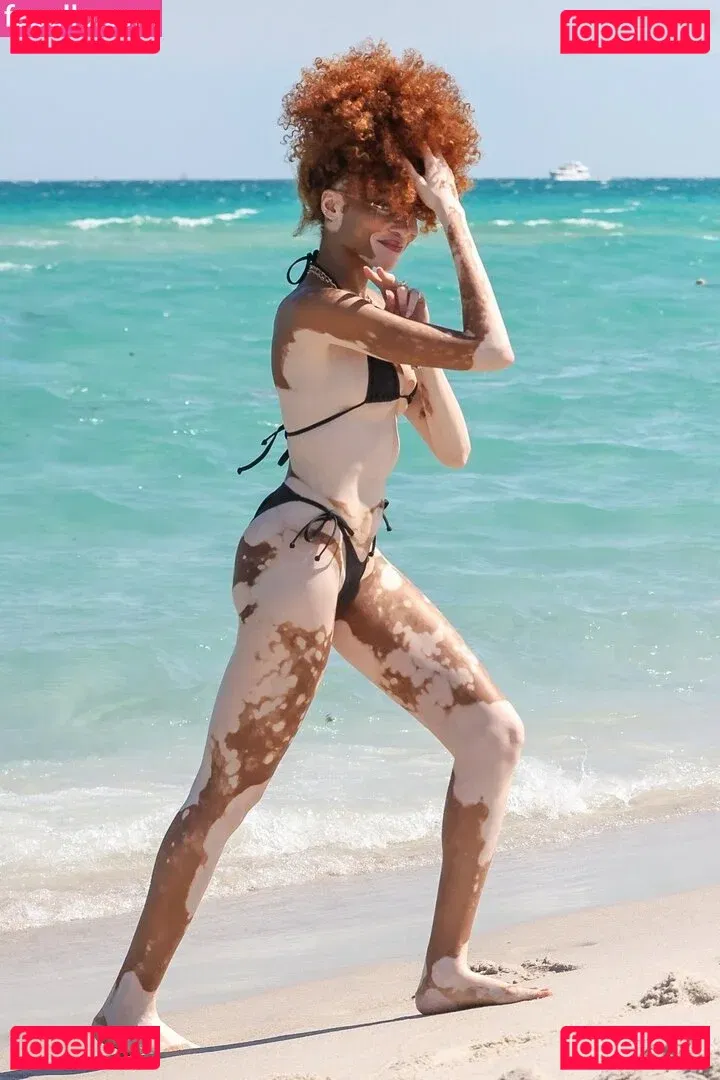 Winnie Harlow Onlyfans Photo Gallery 