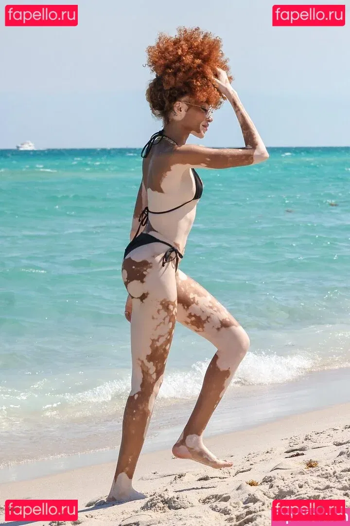 Winnie Harlow Onlyfans Photo Gallery 