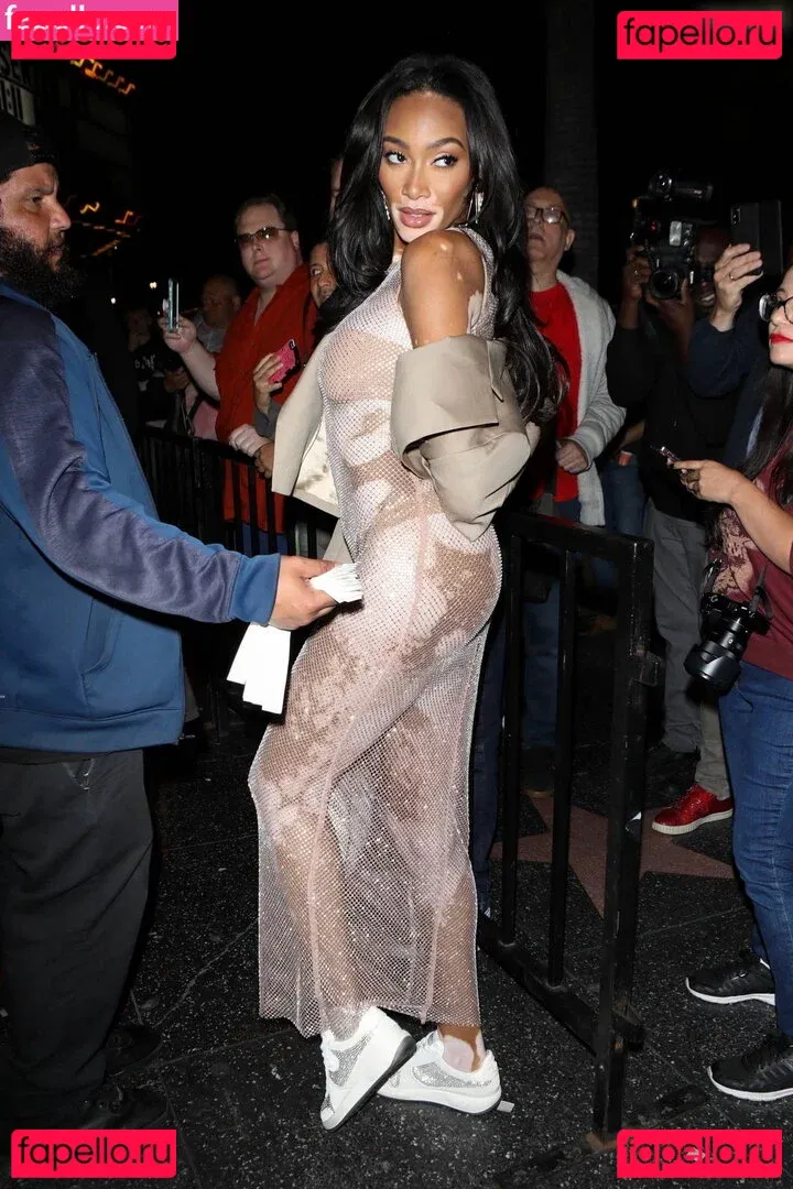 Winnie Harlow Onlyfans Photo Gallery 