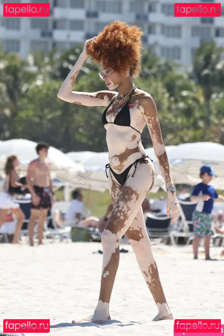 Winnie Harlow Onlyfans Photo Gallery 