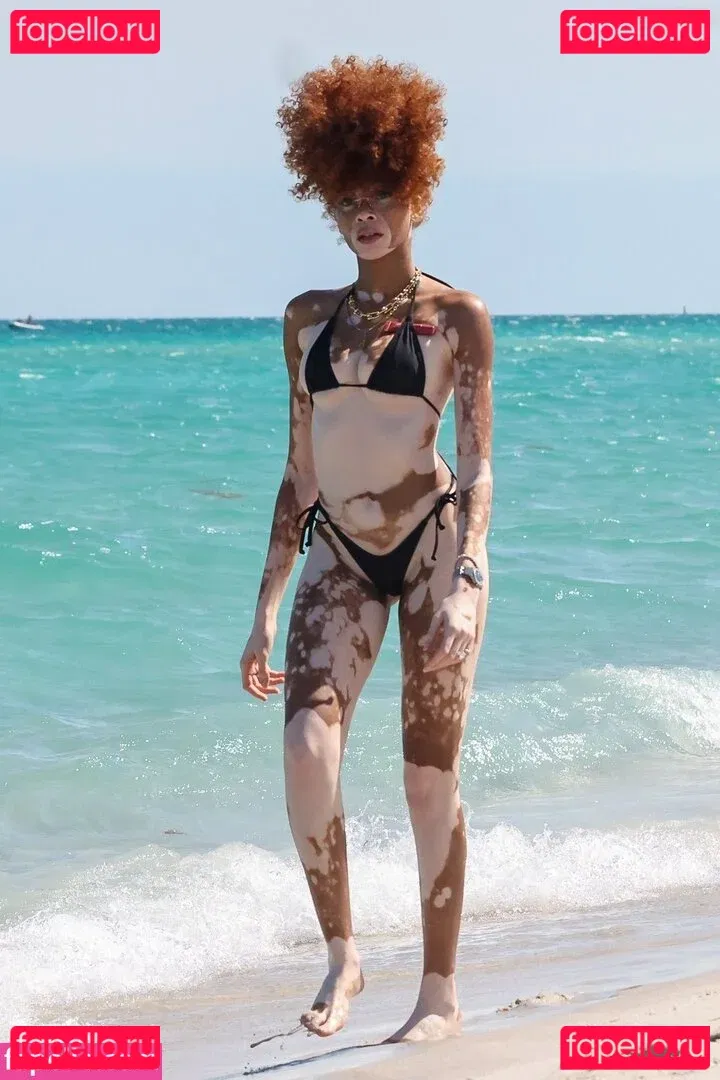 Winnie Harlow Onlyfans Photo Gallery 