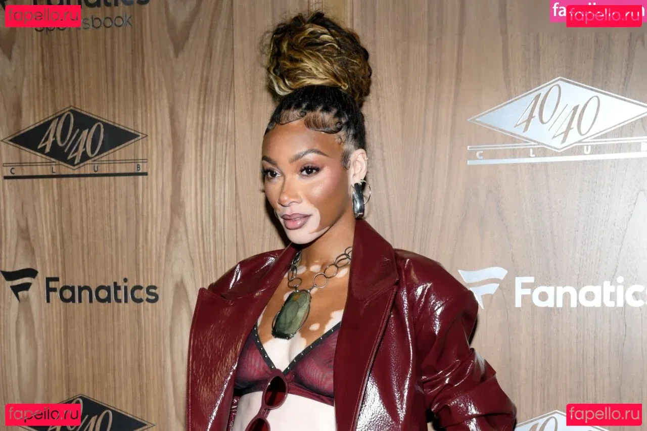 Winnie Harlow Onlyfans Photo Gallery 