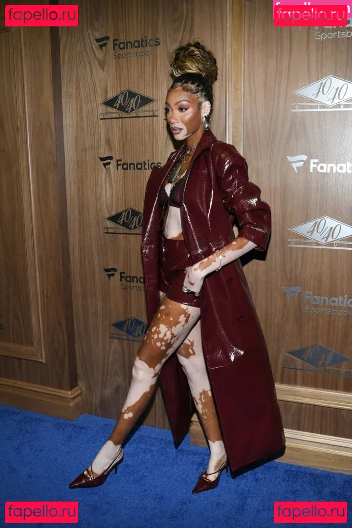 Winnie Harlow Onlyfans Photo Gallery 