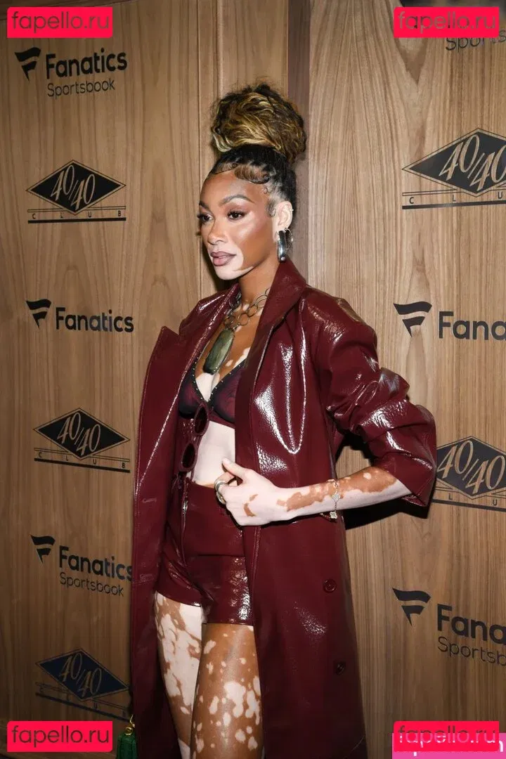 Winnie Harlow Onlyfans Photo Gallery 