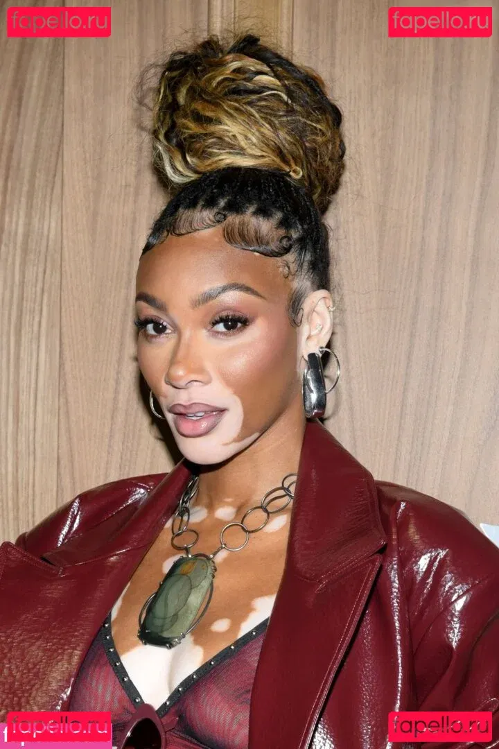 Winnie Harlow Onlyfans Photo Gallery 