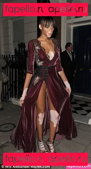 Winnie Harlow Onlyfans Photo Gallery 