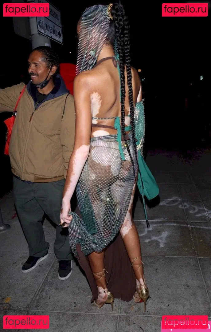 Winnie Harlow Onlyfans Photo Gallery 