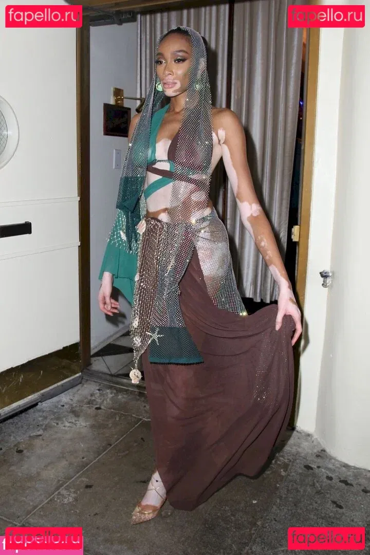 Winnie Harlow Onlyfans Photo Gallery 