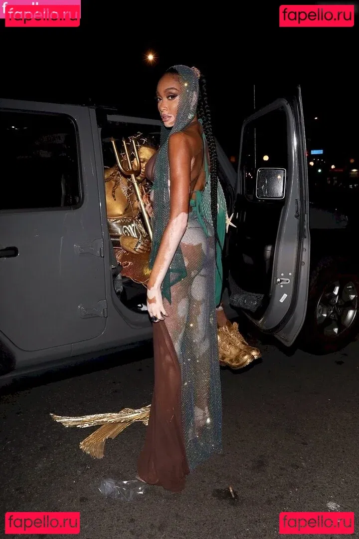 Winnie Harlow Onlyfans Photo Gallery 