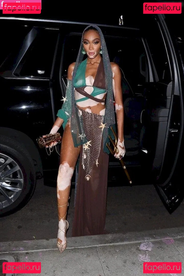 Winnie Harlow Onlyfans Photo Gallery 