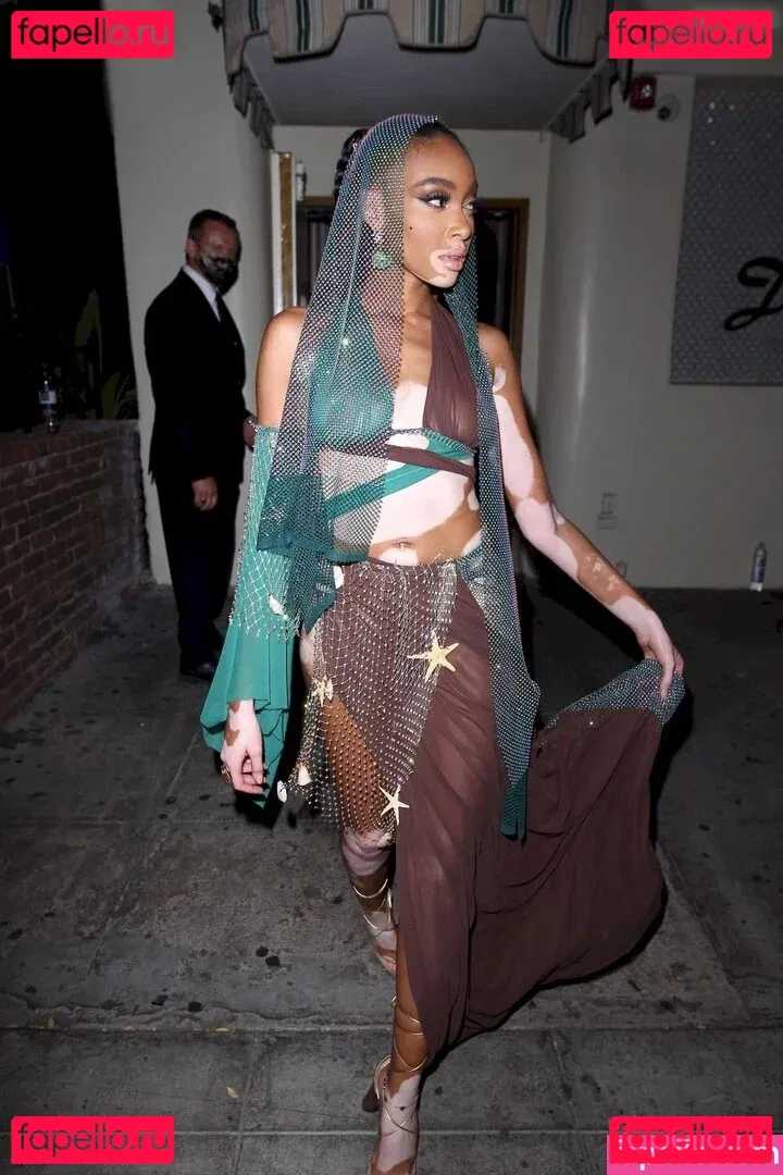 Winnie Harlow Onlyfans Photo Gallery 