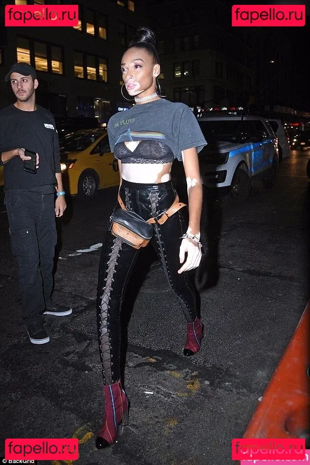 Winnie Harlow Onlyfans Photo Gallery 