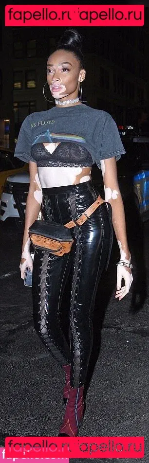 Winnie Harlow Onlyfans Photo Gallery 