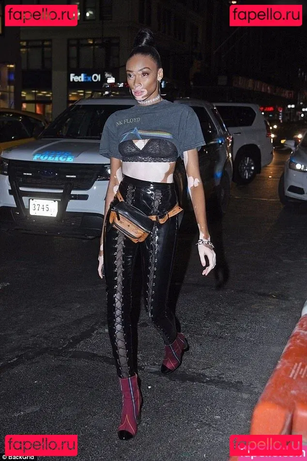 Winnie Harlow Onlyfans Photo Gallery 