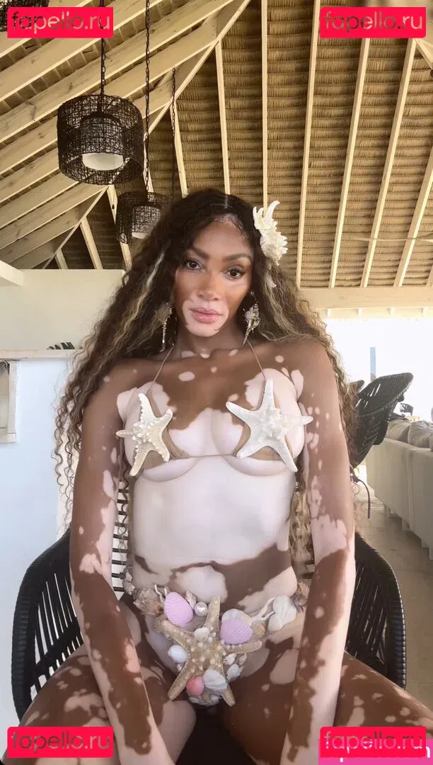 Winnie Harlow Onlyfans Photo Gallery 