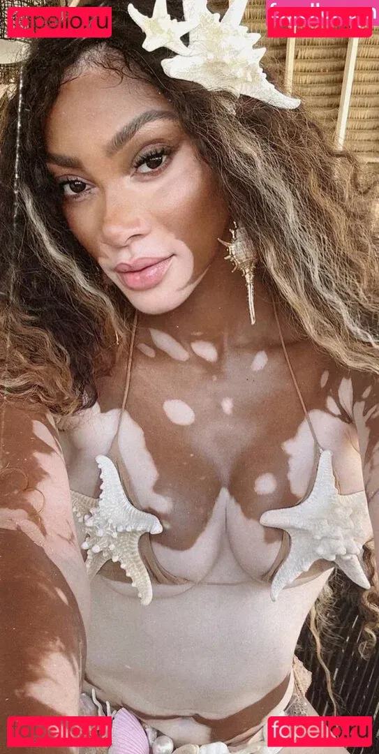 Winnie Harlow Onlyfans Photo Gallery 