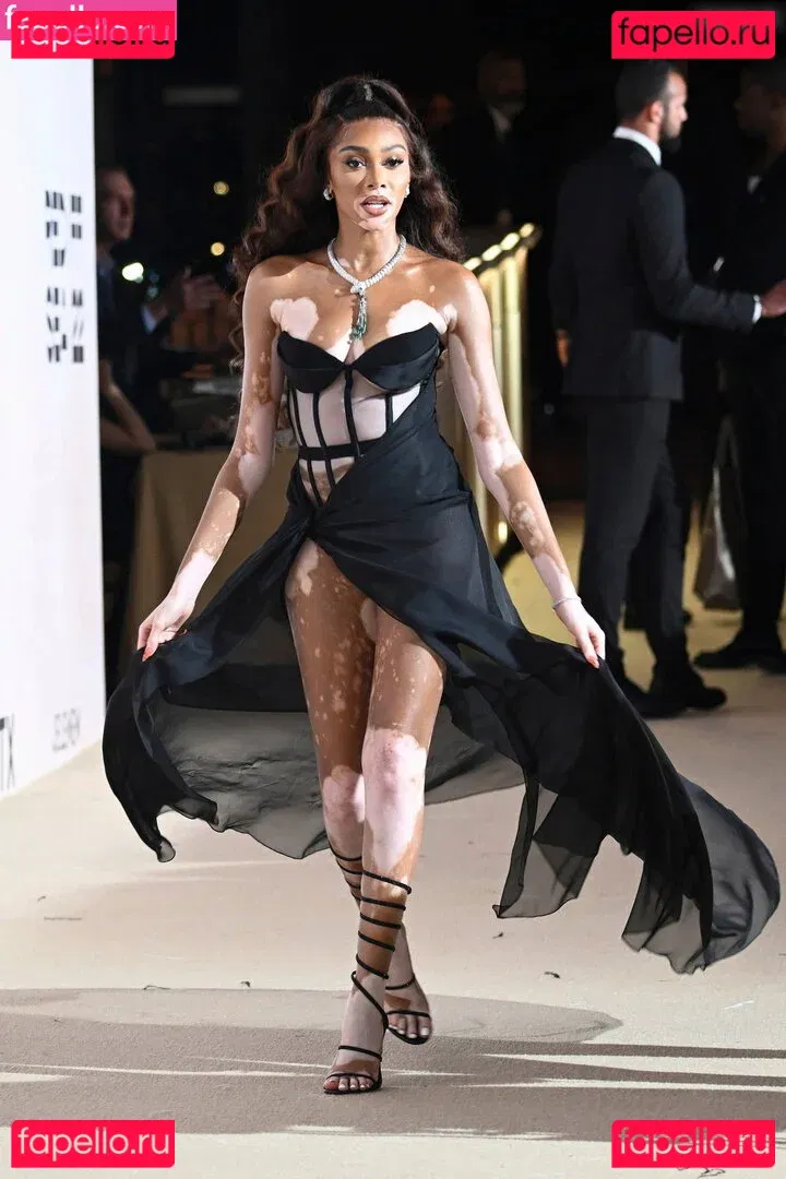 Winnie Harlow Onlyfans Photo Gallery 