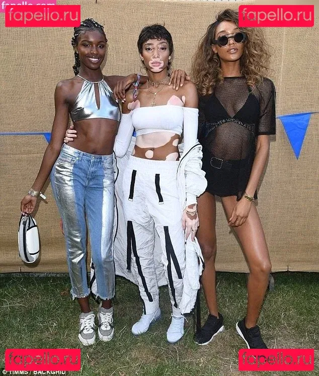 Winnie Harlow Onlyfans Photo Gallery 