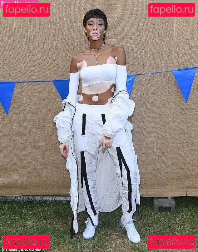 Winnie Harlow Onlyfans Photo Gallery 