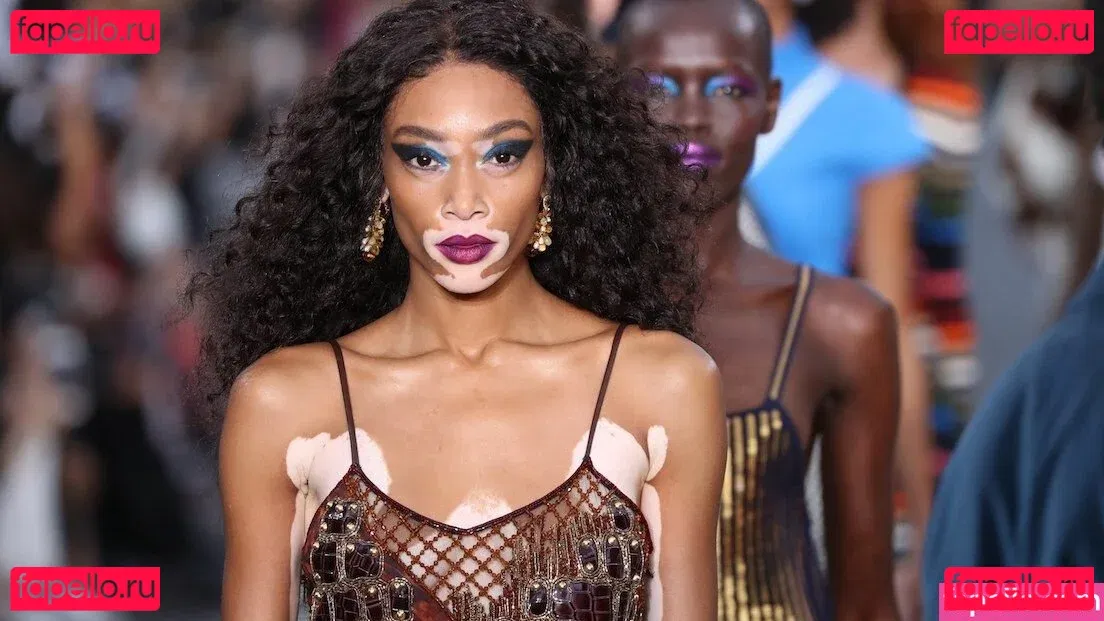 Winnie Harlow Onlyfans Photo Gallery 