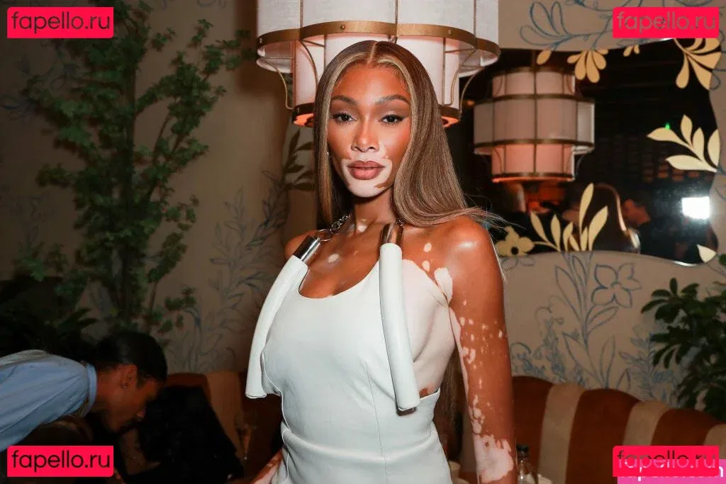 Winnie Harlow Onlyfans Photo Gallery 