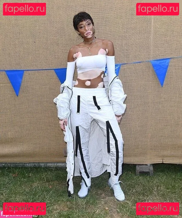 Winnie Harlow Onlyfans Photo Gallery 