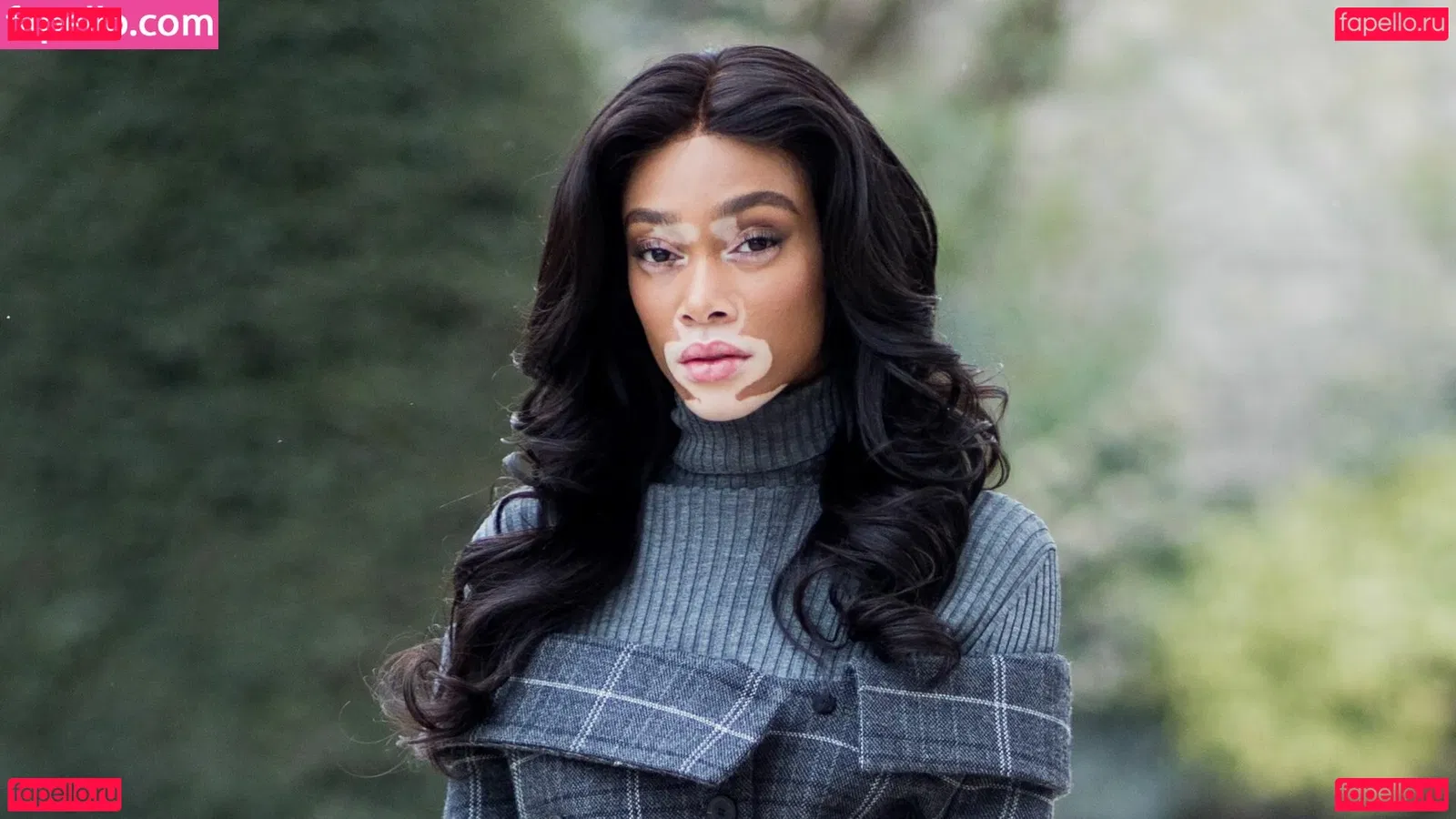 Winnie Harlow Onlyfans Photo Gallery 