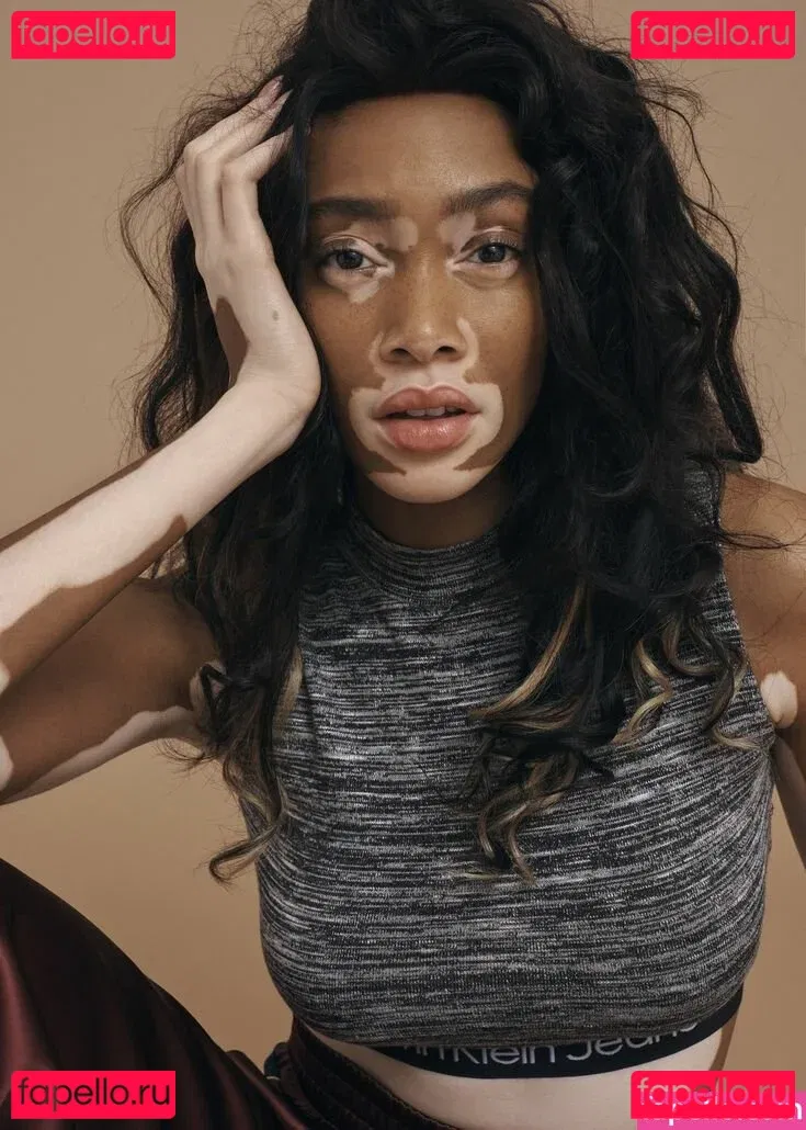 Winnie Harlow Onlyfans Photo Gallery 