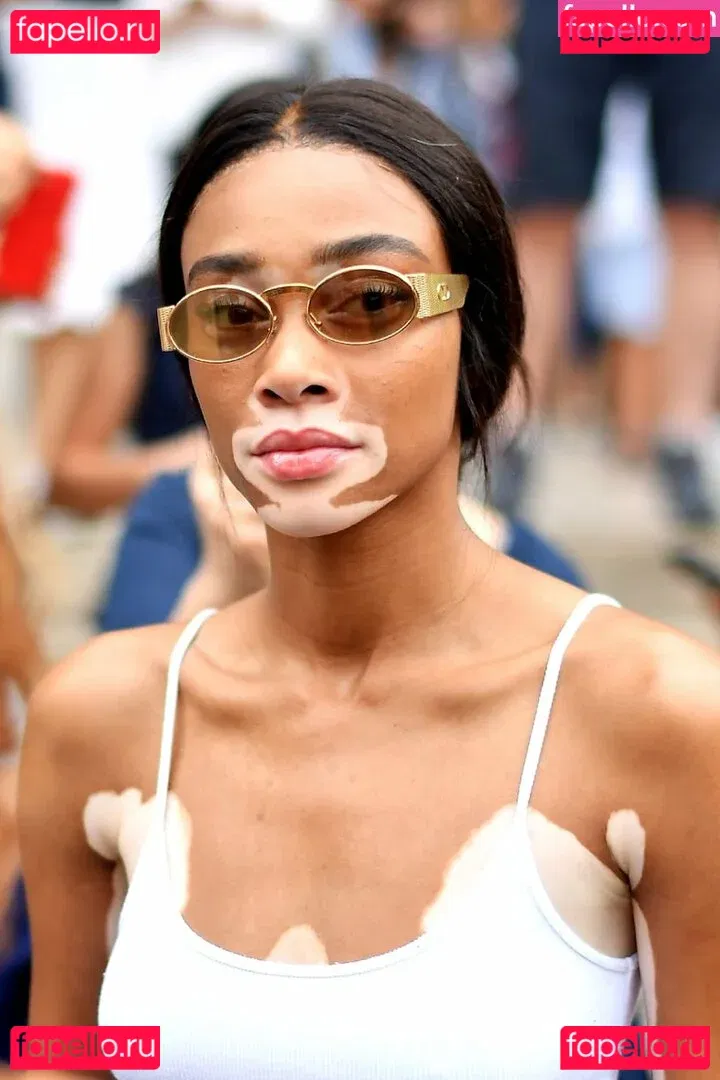 Winnie Harlow Onlyfans Photo Gallery 