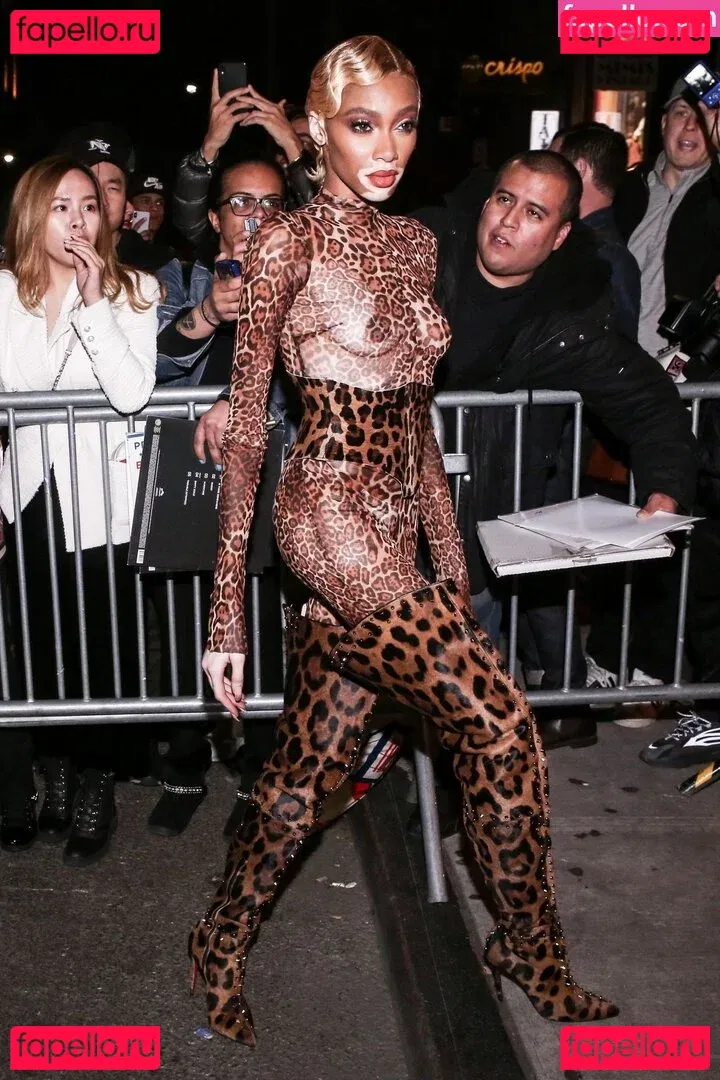 Winnie Harlow Onlyfans Photo Gallery 