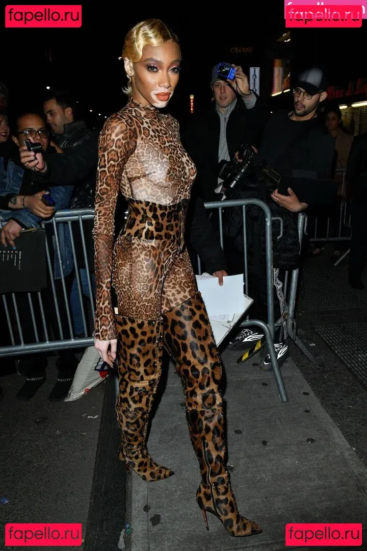 Winnie Harlow Onlyfans Photo Gallery 