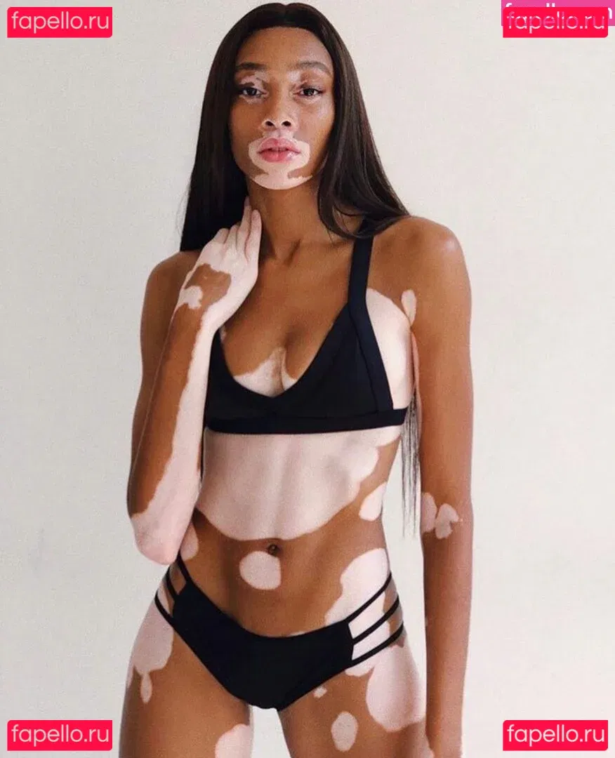 Winnie Harlow Onlyfans Photo Gallery 