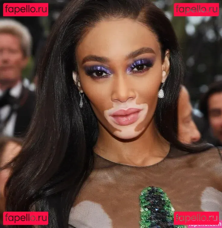 Winnie Harlow Onlyfans Photo Gallery 