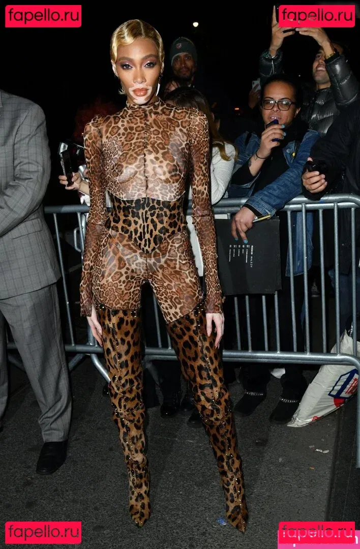 Winnie Harlow Onlyfans Photo Gallery 