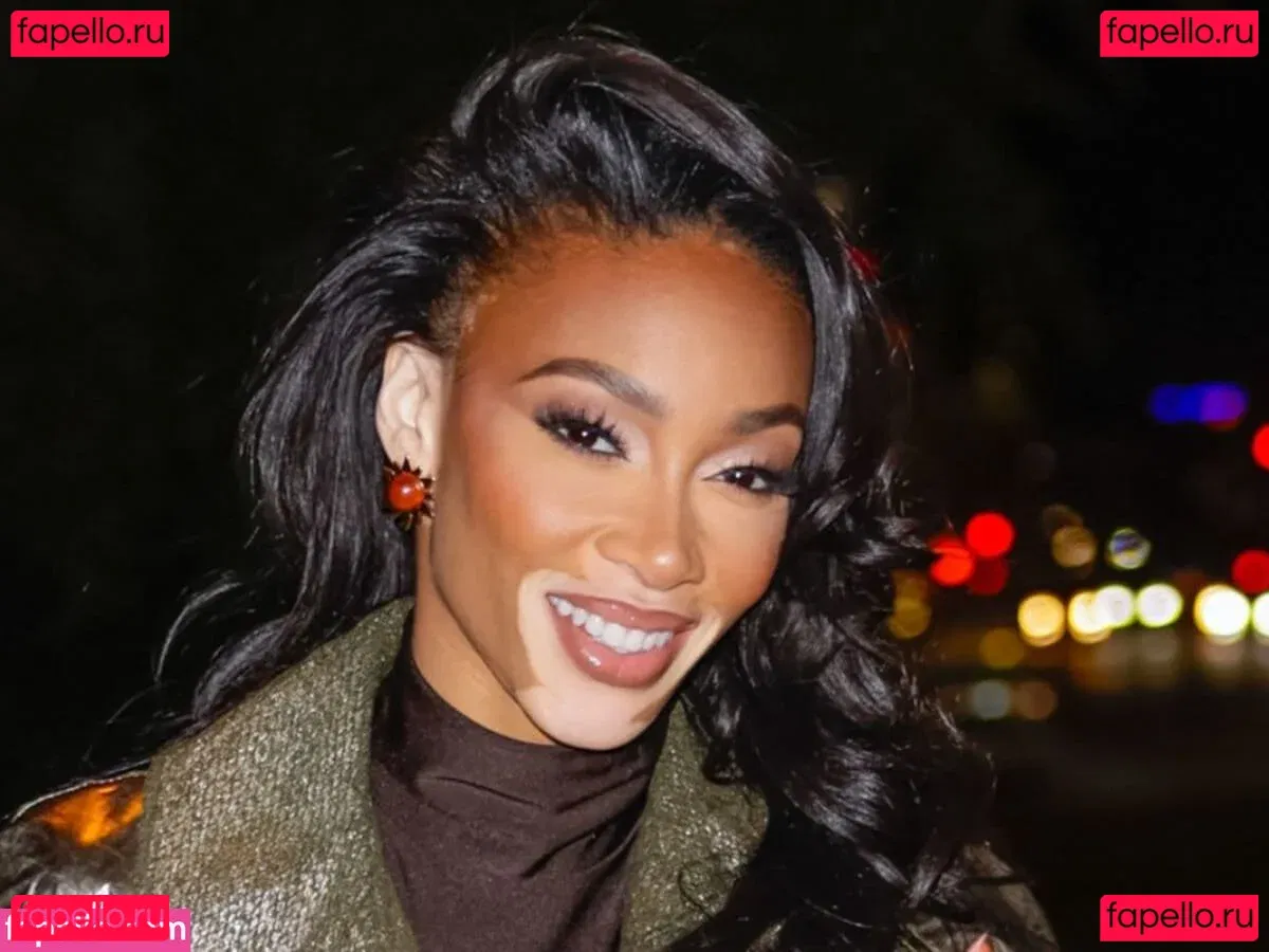 Winnie Harlow Onlyfans Photo Gallery 