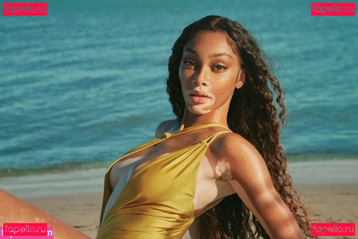 Winnie Harlow Onlyfans Photo Gallery 