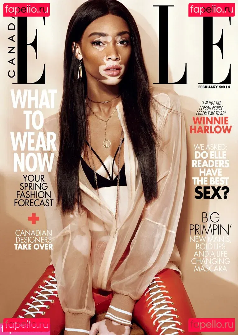 Winnie Harlow Onlyfans Photo Gallery 