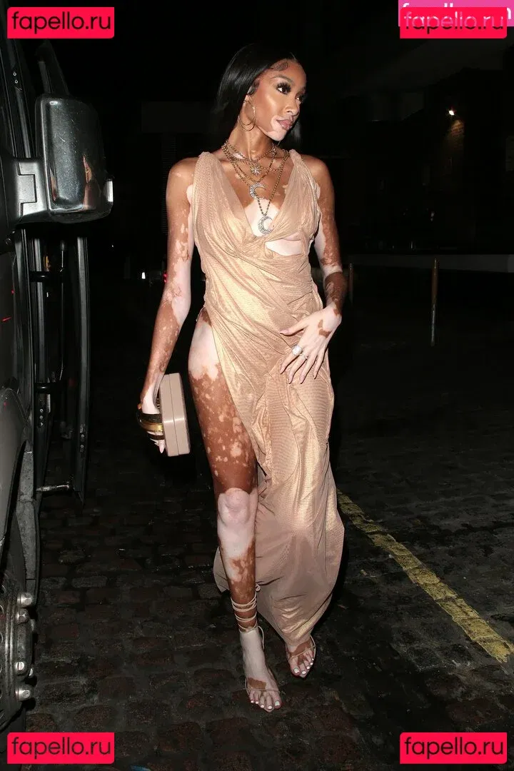 Winnie Harlow Onlyfans Photo Gallery 