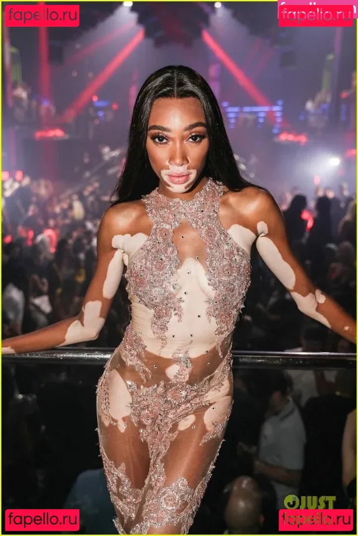 Winnie Harlow Onlyfans Photo Gallery 