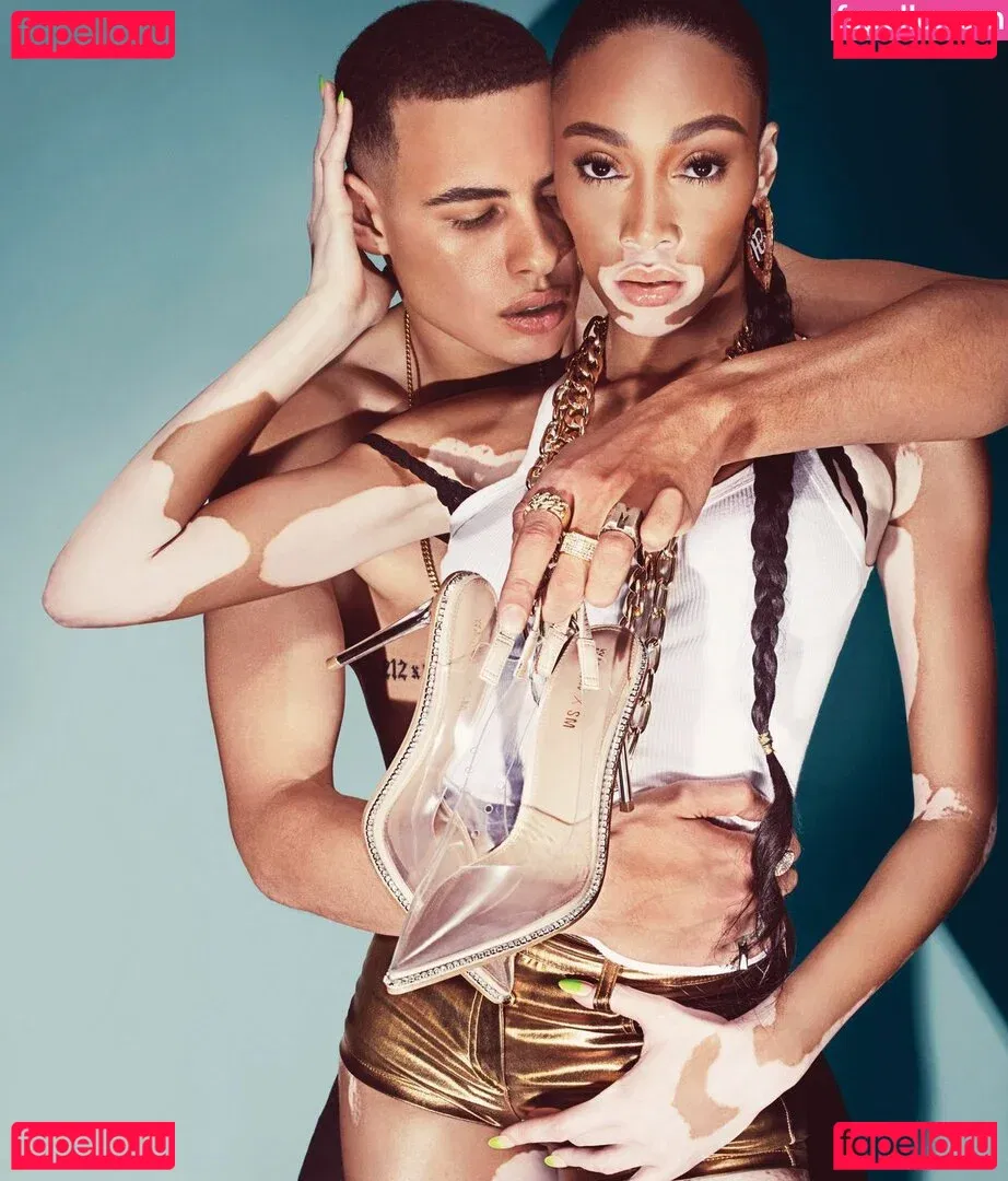 Winnie Harlow Onlyfans Photo Gallery 