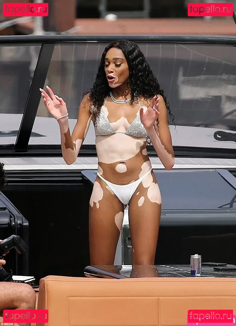 Winnie Harlow Onlyfans Photo Gallery 