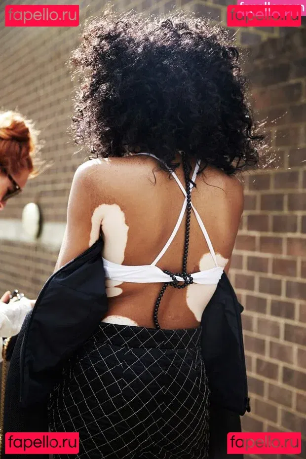 Winnie Harlow Onlyfans Photo Gallery 