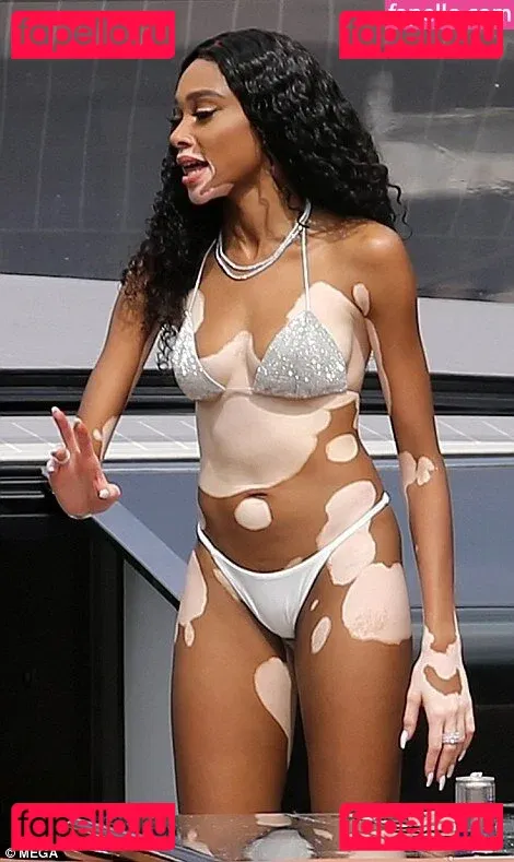 Winnie Harlow Onlyfans Photo Gallery 
