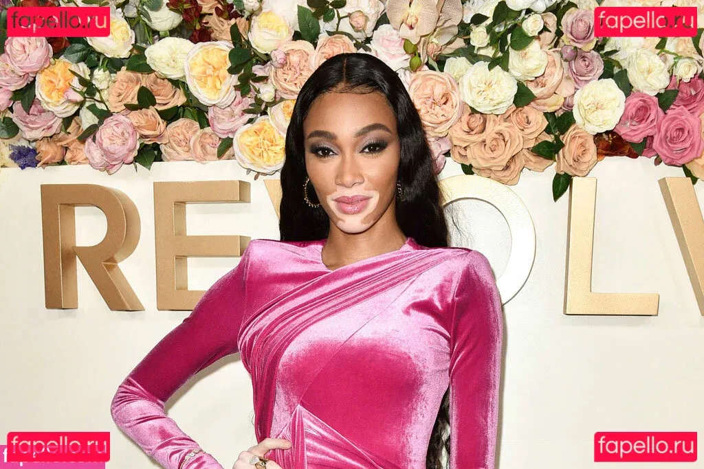 Winnie Harlow Onlyfans Photo Gallery 