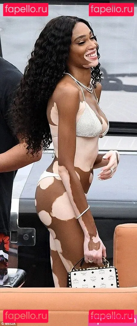 Winnie Harlow Onlyfans Photo Gallery 